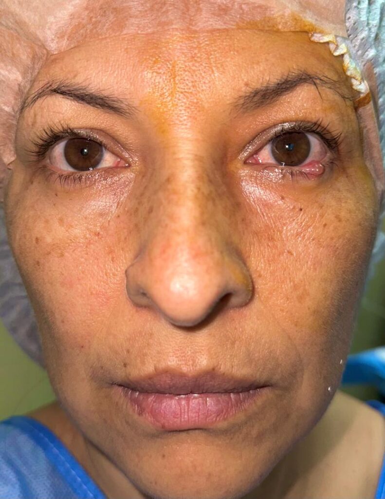 Fuente: Registro fotográfico Dra. Jennifer Rubio