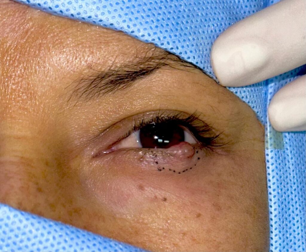 Fuente: Registro fotográfico Dra. Jennifer Rubio