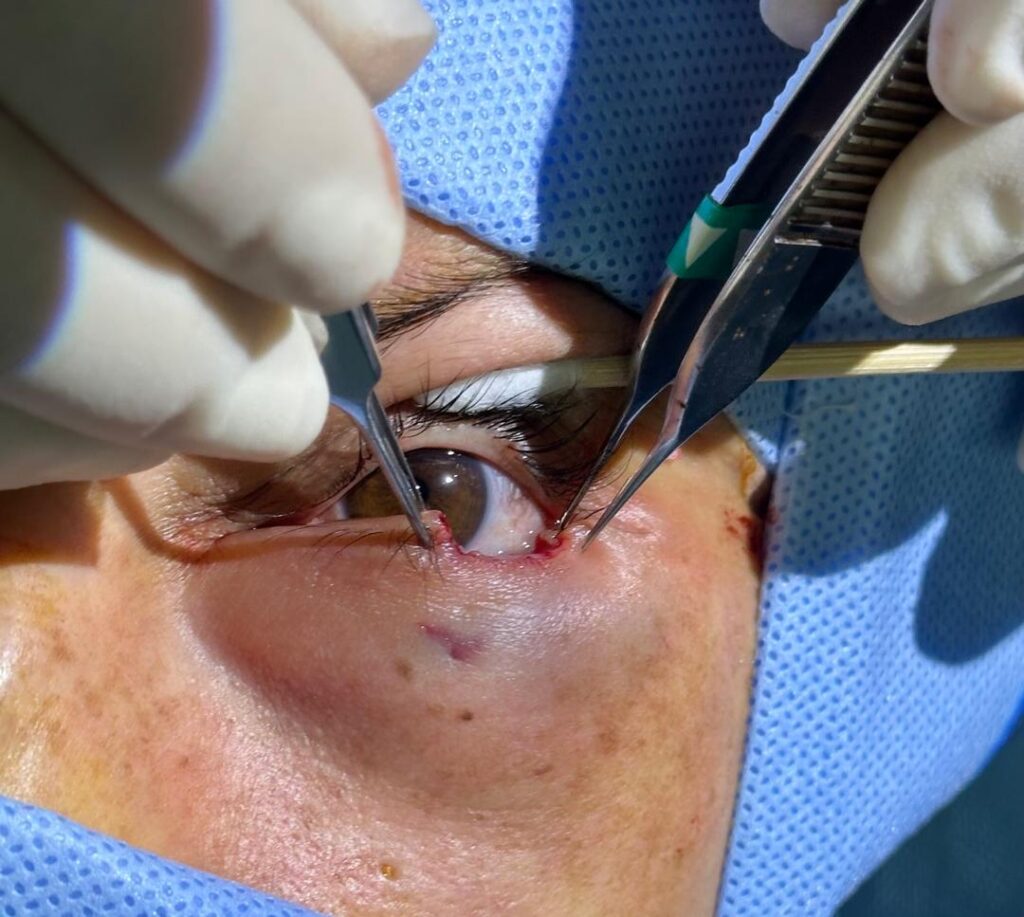 Fuente: Registro fotográfico Dra. Jennifer Rubio